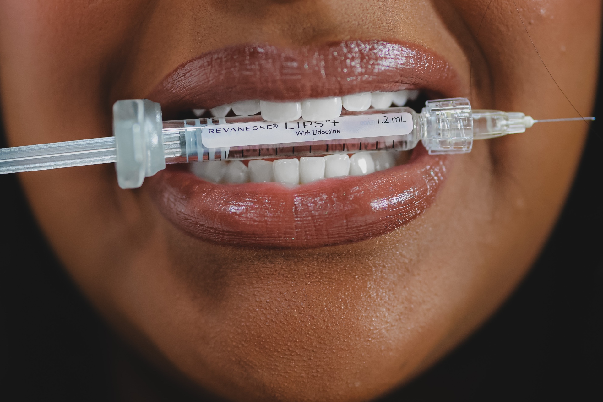 Close-up of glossy lips with a Revanesse Lips+ filler syringe